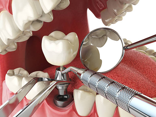 Best 24-Hour Emergency Dental Care in Mcleansboro, IL